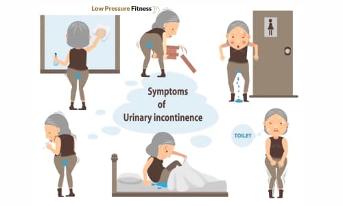 Stress Urinary Incontinence